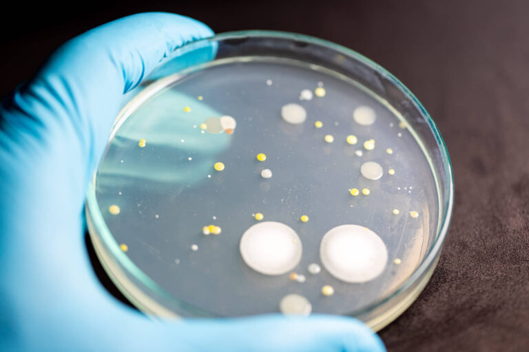 Bacteria in a petri dish